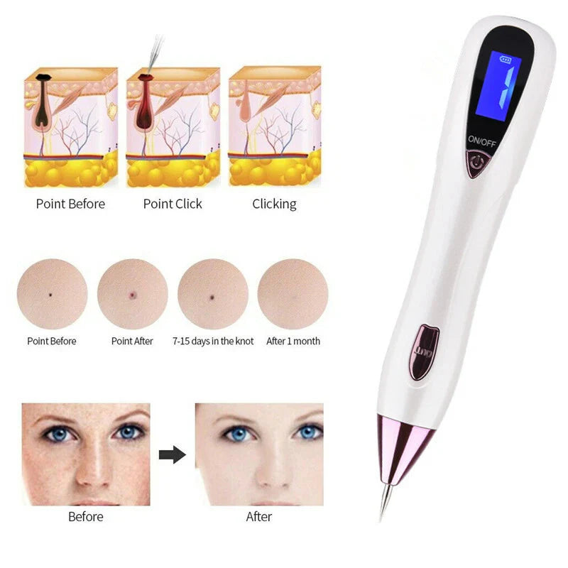 Anti-Aging Laser Plasma Pen Mole Removal Dark Spot Skin Tag Tattoo Wart Remover